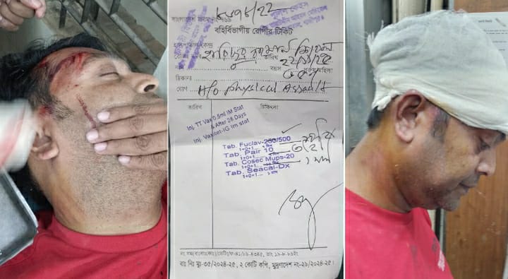 শত্রুতার জেরে গাজীপুরে সাংবাদিককে কুপিয়ে জখম ।