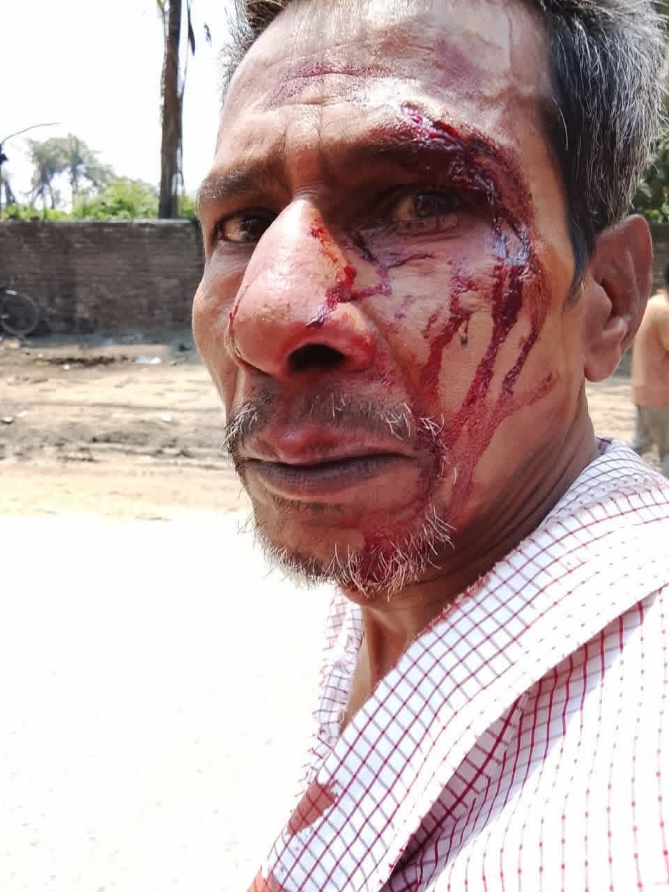 আওয়ামী লীগ নেতাকর্মীদের বিরুদ্ধে হামলার অভিযোগ, আহত বিএনপি কর্মী