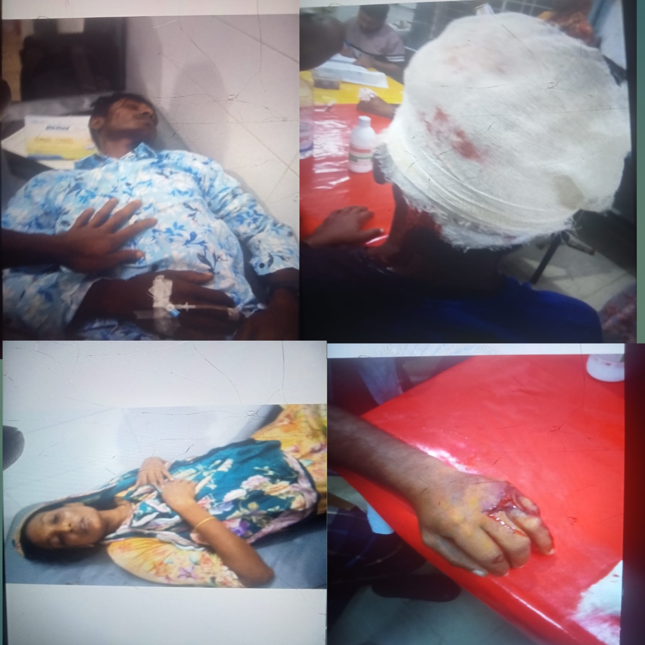 গোপালগঞ্জের নিজড়া ইউনিয়নে দু’পক্ষের সংঘর্ষে আহত ১৩
