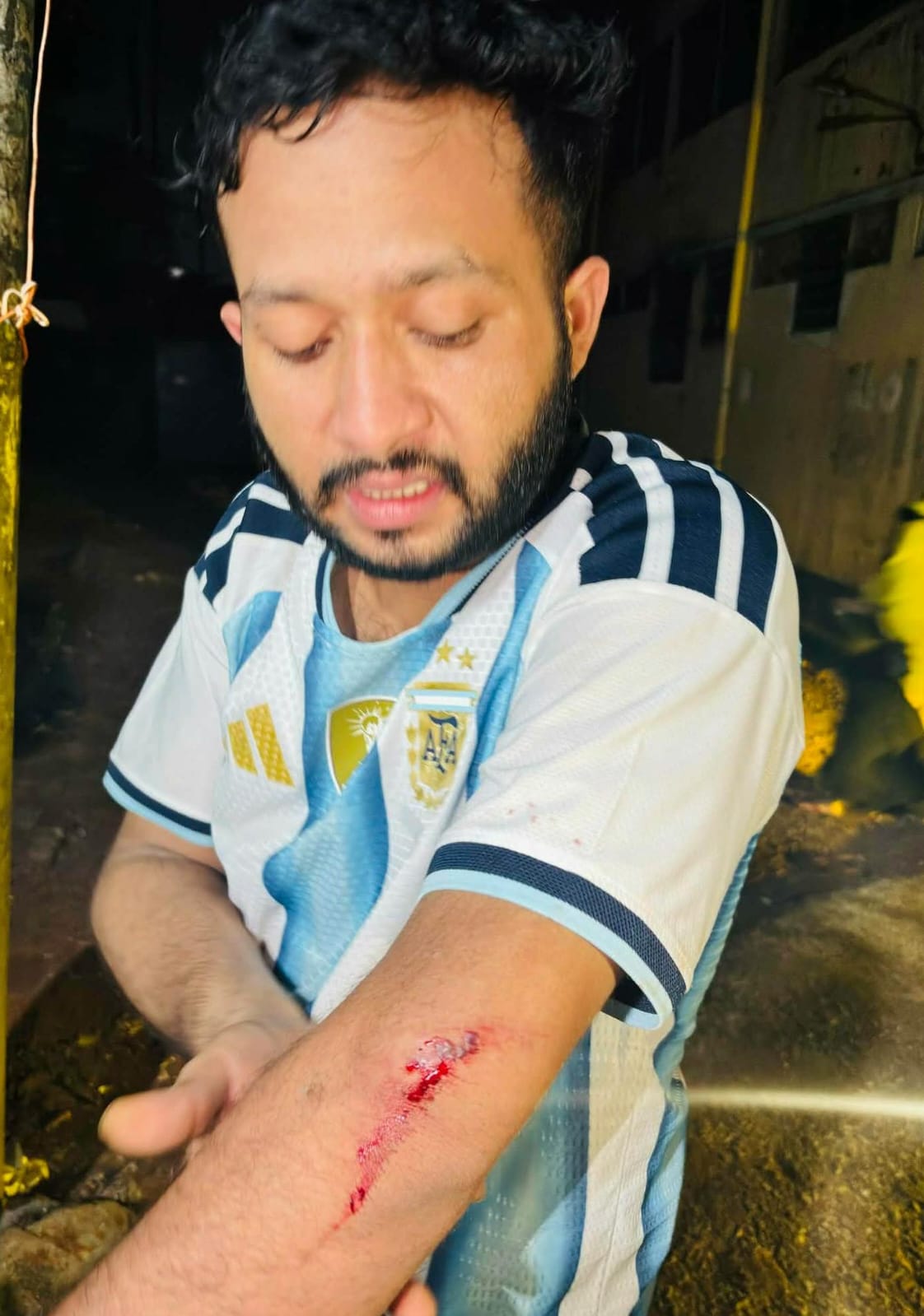 টঙ্গীতে ছাত্রদল নেতা দিপু দেওয়ানের ওপর হামলার ঘটনা আড়াল করতে সাজানো অভিযোগ।
